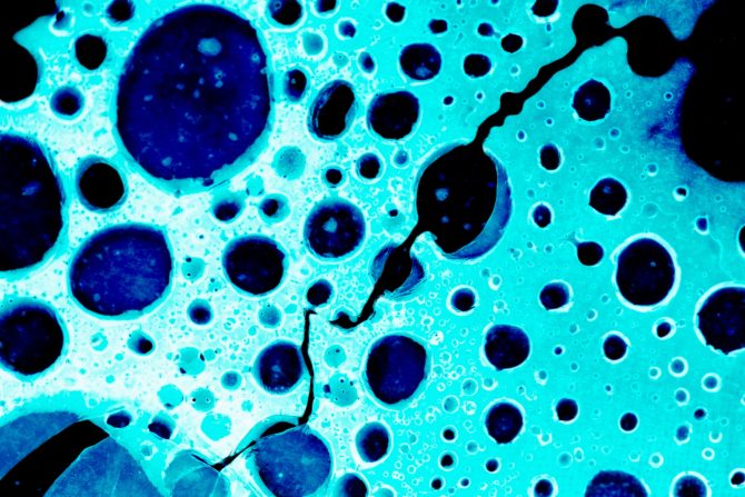 metastatski rak pankreasa