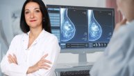 Mamografija – benefiti u ranom otkrivanju karcinoma dojke i mitovi o zračenju