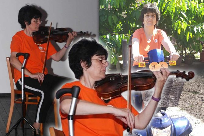 Miltipla skleroza Milica Simić