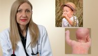 Zašto deca sve češće pate od raznih alergija