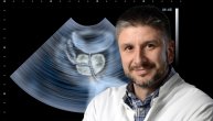 Biopsija prostate – kako izgleda, koliko tkiva se uzima, koje vrednosti PSA su indikacija za ovo ispitivanje