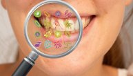 Kako mikrobi u ustima utiču na razvoj oralnog karcinoma?