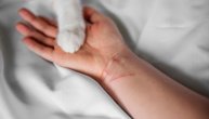 Bolest mačjeg ogreba praćena je otocima – kako se leči, na koji način da se zaštitimo
