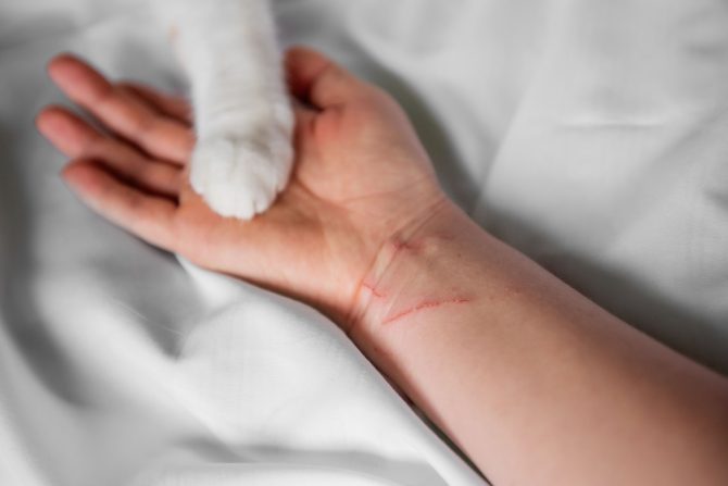 bolest mačjeg ogreba