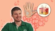 „Ne plašite se, ni mi ni psorijaza nismo zarazni“: Markov apel je ljudski i moćan