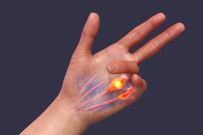 Bolesti mišićno-skeletnog sistema