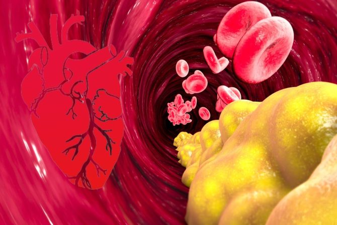 Prolećna karidološka radionica