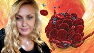 Trombofilija je urođena ili stečena: Šta sve povećava rizik od nastanka tromba priča nam dr Mirjana Mitrović