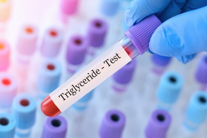 trigliceridi