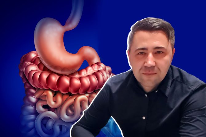 Sindrom nervoznih creva