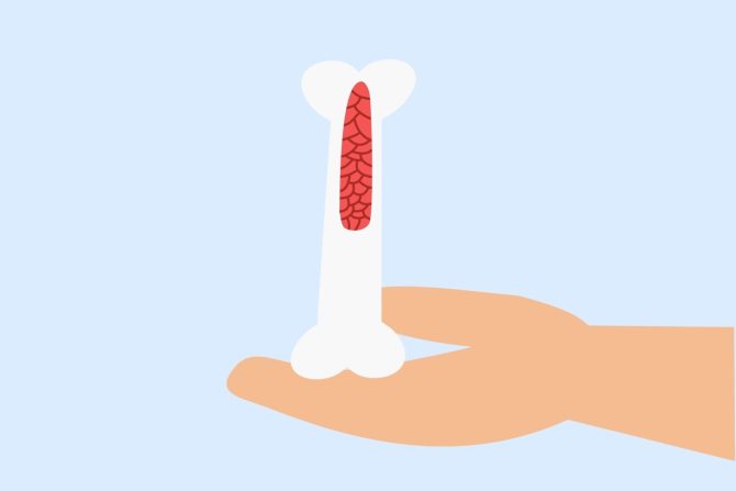 poremećaj koštane srži