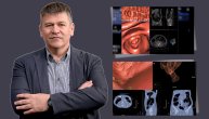 Čitaoci pitaju: Da li je CT kolonografija ili virtualna kolonoskopija adekvatna zamena za klasičnu kolonoskopiju