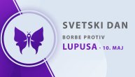 Sistemski lupus napada skoro sve organe, stradaju mozak i bubrezi, pacijenti čekaju biološku terapiju