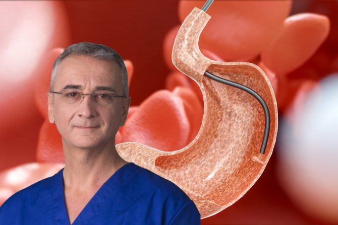 Polipi u želucu dr Miloš Bjelović