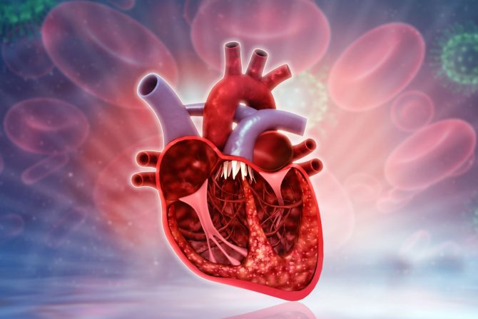 kardiovaskularne bolesti