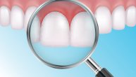 Kako se leči povlačenje desni i može li se gingivitis sprečiti