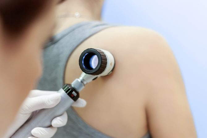 očigledni znaci raka kože