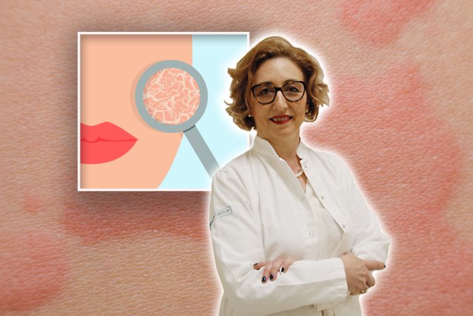 Koža mehurići osip svrab