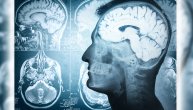 Hormonski disbalans posle povrede glave: Šta je i kako se leči hipopituitarizam
