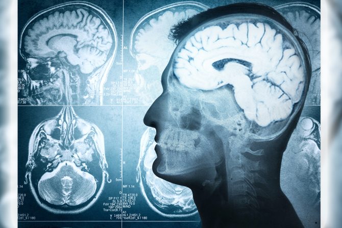 hormoni i povrede glave