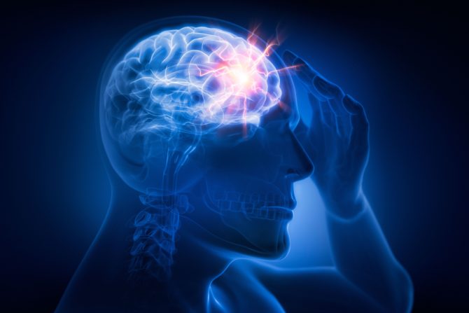 Bol sa jedne strane glave