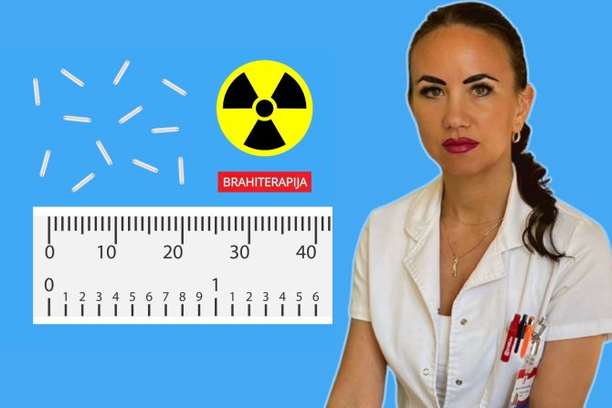 brahiterapija