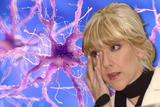 Sindrom ukočene osobe