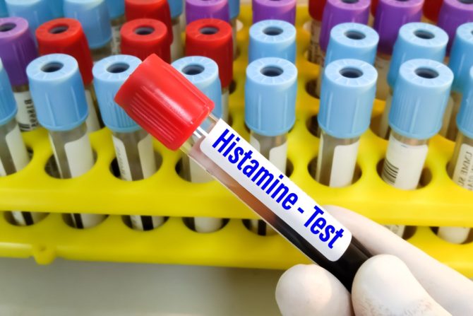intolerancija na histamin