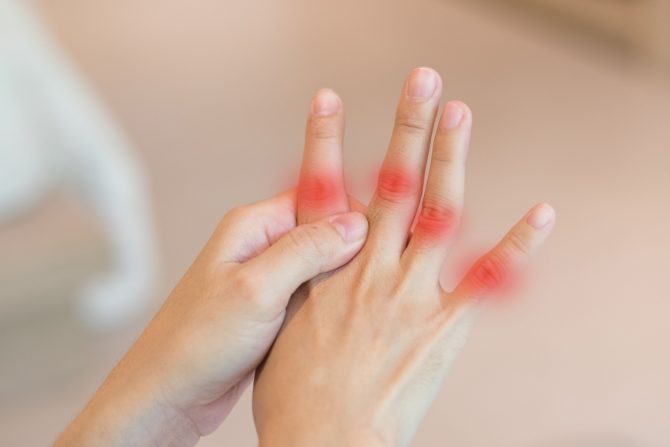 mokraćna kiselina i giht