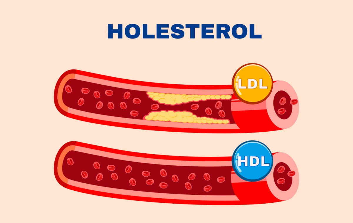 LDL HDL holesterol
