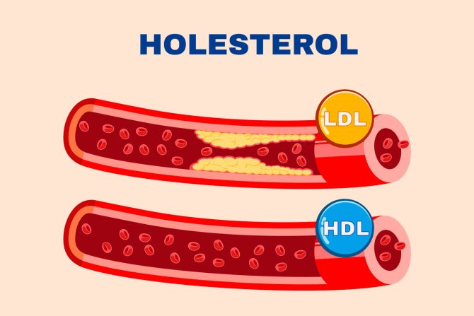 holesterol