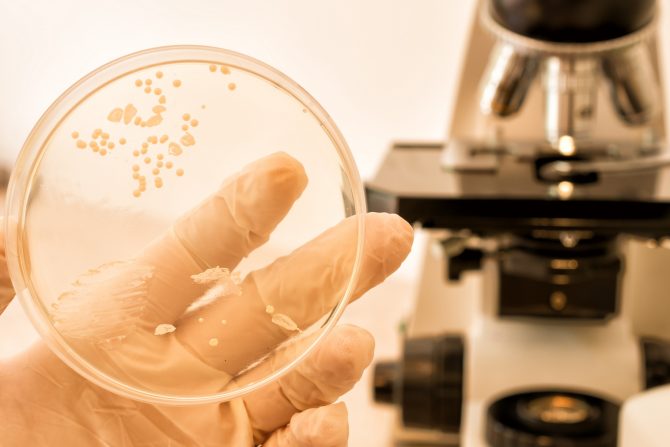 gljivična infekcija