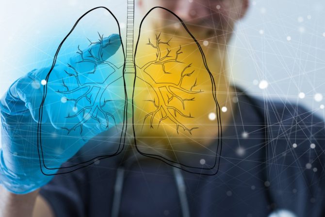 Skrining na rano otkrivanje raka pluća