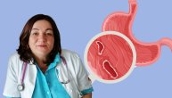 Doktorka Bošnjak o prvim simptomima čira na želucu ili dvanaestopalačnom crevu: Koliko vremena je potrebno za izlečenje ulkusa