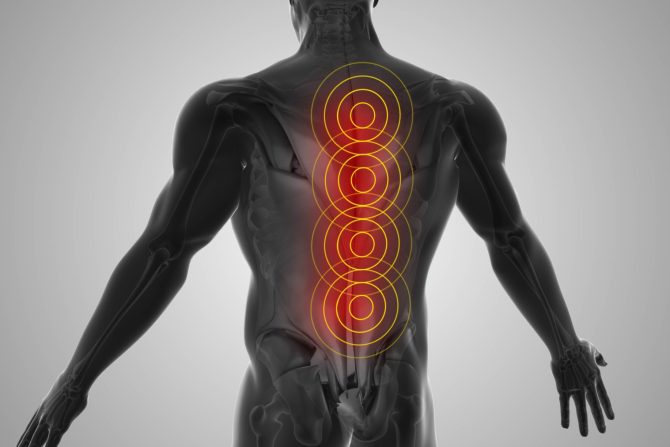 Inflamatorni bol u leđima