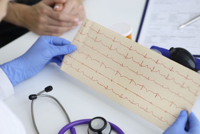 bol nakon srčanog udara