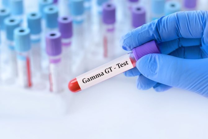 GGT test
