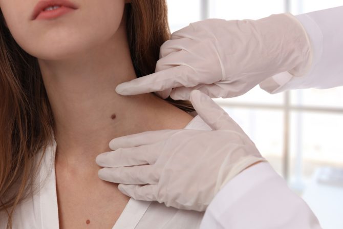 mladeži i viseći mladeži