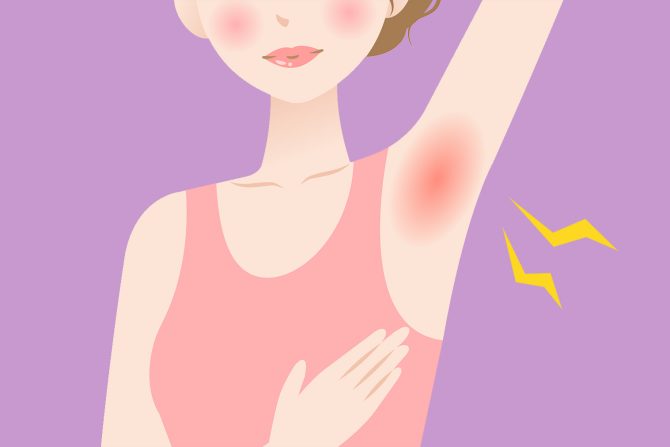 kvržica ispod pazuha