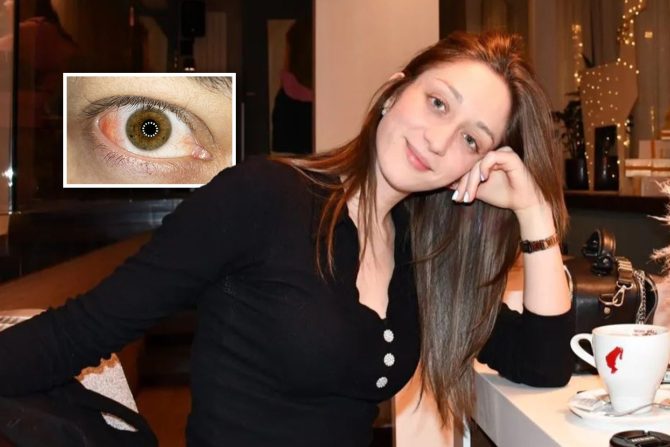 Skleritis Nevena Plazinić