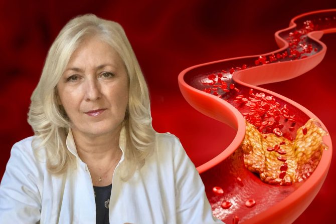 hiperholesterolemija