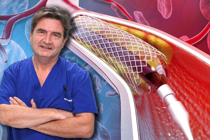 vaskularne intervencije