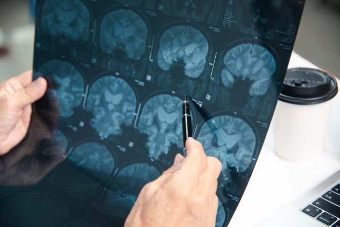 podtipovi depresije i anksioznosti