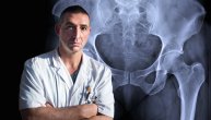 Koji pacijenti su kandidati za najmoderniju, minimalno invazivnu metodu zamene zgloba kuka: Ortoped dr Oliver Dulić o detaljima „bikini” intervencije