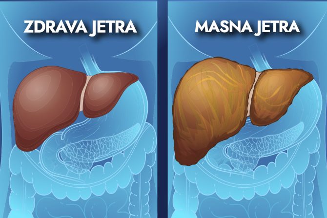 masna jetra