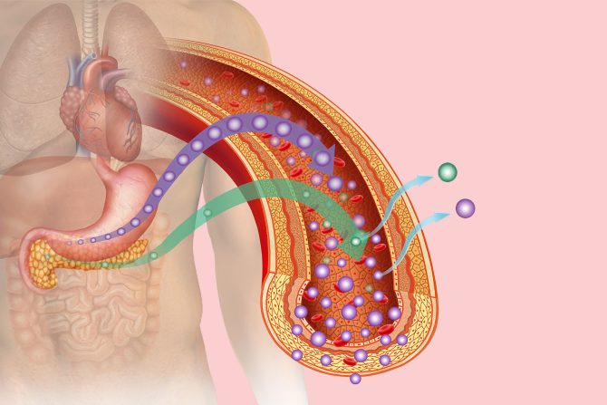 zavisnost od insulina