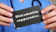 Nevidljiva patnja mladih: Hidradenitis suppurativa i borba sa hroničnim bolom