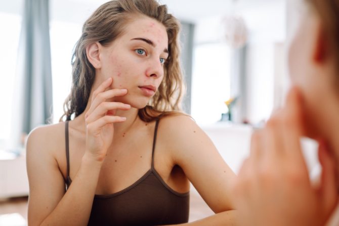 probiotici u nezi kože