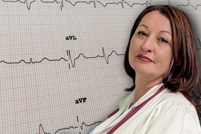 blok desne grane srca