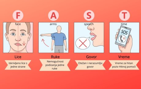 moždani udar